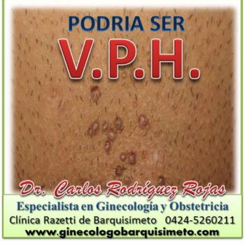 V.P.H. ¿Conoces el  Virus del Papiloma Humano?